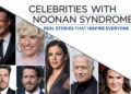 Celebrities With Noonan Syndrome