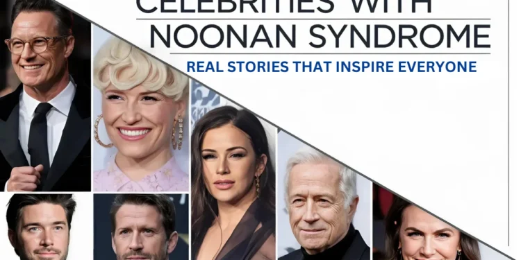 10 Inspiring Celebrities With Noonan Syndrome 30 Celebrities With Noonan Syndrome