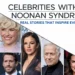10 Inspiring Celebrities With Noonan Syndrome 6 Celebrities With Noonan Syndrome